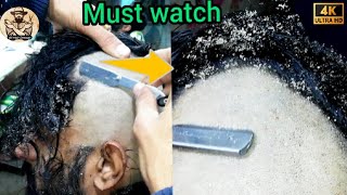 Head shave How To😱Dandruff Remove head shave tutorial for Mens 2023 Bald Dandruff Remove headshave [upl. by Dnaloy]