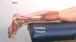 Achilles Tendonitis  Tendinopathy  Explained in 90 Seconds [upl. by Ahsieyn]