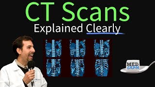 CT Scan of the Chest Explained Clearly  High Resolution CT Scan HRCT [upl. by Idihc280]