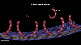 Antiphospholipid syndrome [upl. by Billie468]