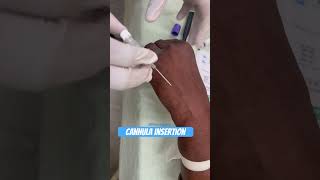 Cannula insertion of female patient shorts nurses subscribe [upl. by Dian591]