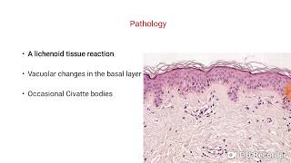 Dermatomyositis Part 3 [upl. by Amadis]