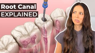 What Is A Root Canal amp Should You Get One [upl. by Idelson]