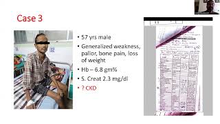 Hypercalcemia Case Based Approach Dr Sumit Chakraborty [upl. by Letrice]