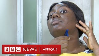 Chidube une femme qui souffre dhirsutisme et qui encourage les autres sur les réseaux sociaux [upl. by Dong379]