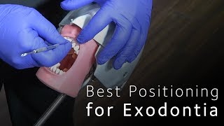 Best Positioning for Minimally Invasive Exodontia [upl. by Yelak416]