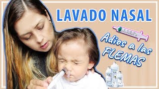 Lavado nasal en niños pequeños con suero fisiológico [upl. by Adnarb]