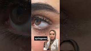 Syringomaجلديةدفاتنبخار ديرموركلينك dermoreclinic drfatenbukhari ليزر بشرة جلدية laser [upl. by Seilenna42]