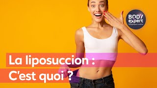 CHIRURGIE ESTHÉTIQUE  La liposuccion  C’est quoi   BODYEXPERT [upl. by Diamante]