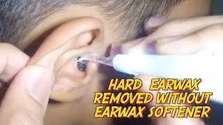 School Boys Hard Earwax Removed Without Earwax Softener [upl. by Ynitsed]