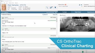 CS OrthoTrac Charting Overview Demo  An Excerpt from a Recent Webinar [upl. by Desdamona]