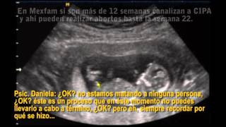 Clínicas realizan abortos a 22 semanas de embarazo en CDMX [upl. by Nyltiak]