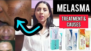 What is Melasma  How to cure Melasma  amp Causes Explained  Mrunali Chaudhary [upl. by Ozne]