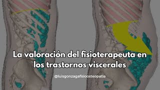 Fisioterapia y el sistema visceral [upl. by Nnylsor]