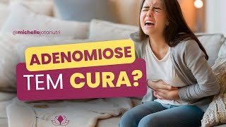 A ADENOMIOSE tem cura [upl. by Atener]