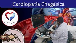 CardiopatÍa chagásica [upl. by Epillihp]