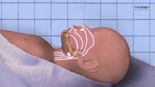 How to perform Neonatal Resuscitation Resuscitate Newborn NLS Newborn Life Support 2015 guidance [upl. by Charline]