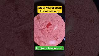 Stool test  Stool microscopic examination  Stool microscopy microbiology shorts trending viral [upl. by Ocirema]