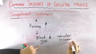 Compartment syndrome  Common injuries of skeletal muscle  Biomechanics of skeletal muscle [upl. by Aisiat328]