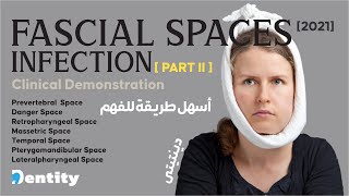 شرح مبسط  Fascial Spaces Infection  PART 22 [upl. by Essila769]