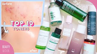 Best Toners for Acne Hyperpigmentation Large Pores Whiteheads amp Blackheads [upl. by Aidam]