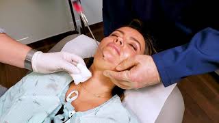 In Office Chin Liposuction [upl. by Hali]