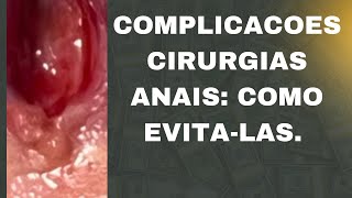 Proctologista ensina evitar complicações após cirurgias Hemorroidasfissurasfístulasverrugas hpv [upl. by Ragland]