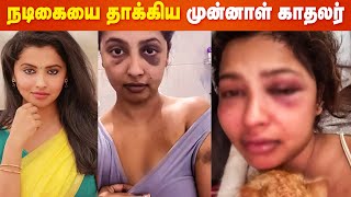 Actress Anicka Vikhraman accuses ExBoyfriend quotசித்தரவதை அனுபவிச்சேன்😭quot [upl. by Assirac600]