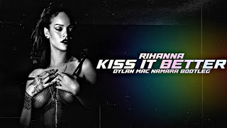 Rihanna  Kiss It Better Dylan Mac Namara Bootleg [upl. by Mundt]