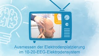 Ausmessen der Elektrodenplatzierung im 1020EEGElektrodensystem [upl. by Elizabet]