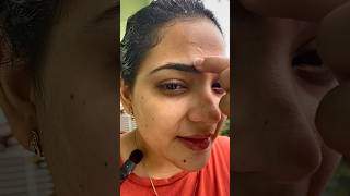 Tretinoin Users Prevent Forehead Acne by Skipping This Hair Oil Habit tretinoin ashortaday dr [upl. by Om]