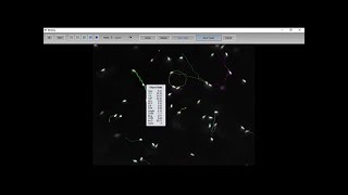 MMC Sperm Siberian sturgeon sperm motility analysis [upl. by Haskell713]