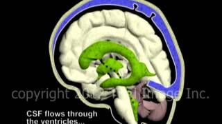 Hydrocephalus and Cerebrospinal Fluid CSF circulation by Dr Cal Shipley MD [upl. by Yenrab]