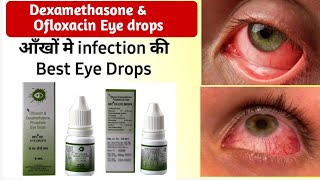 ofloxacin dexamethasone eye drops use dosage side effects in hindi  OFC DX eye drops in hindi [upl. by Kathy]