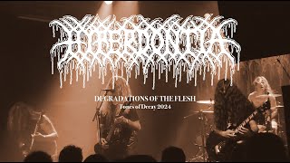 Hyperdontia  Degradations of the Flesh Live at Tones of Decay  Prague Czech Republic 2024 [upl. by Caputto]