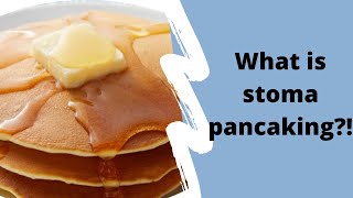 WHAT IS STOMA PANCAKING HOW TO PREVENT STOMA PANCAKING STOMACOLOSTOMY CARE [upl. by Katz]