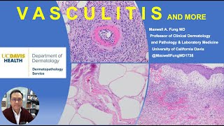 DERMATOPATHOLOGY Vasculitis Vasculopathy amp More [upl. by Chrysler169]