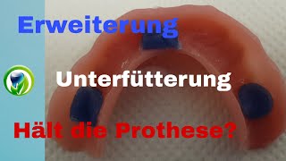 Erweiterung und Unterfütterung einer Unterkiefer Totalprothese  Saugt die Prothese immer [upl. by Yht]