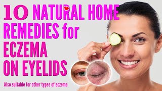 10 Best Natural Home Remedies for Eczema on Eyelids  how to treat eczema eyelids 2021 [upl. by Atiluj]