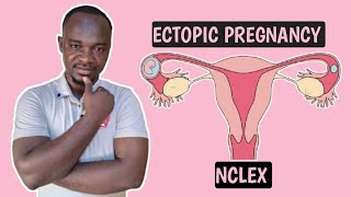 ECTOPIC PREGNANCY for nurses and all NCLEX student [upl. by Crudden]