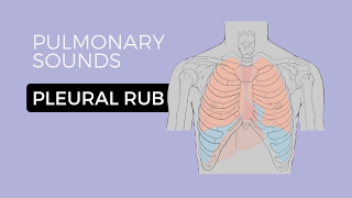 05  Lung Sounds  Pleural friction rub 🎧 [upl. by Selway]