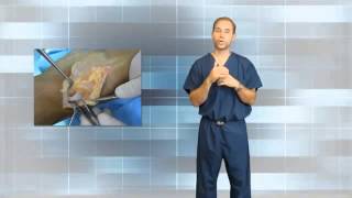 What is a Ganglion Cyst A Tennessee Podiatrist Explains [upl. by Okier]