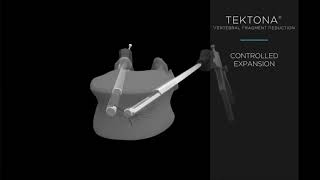 Spineart Tektona VFR [upl. by Ginsberg]