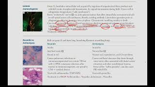 Listeria Monocytogenes Nocardia vs Actinomyces  Microbiology  13  First Aid USMLE in UrduHindi [upl. by Bertila]