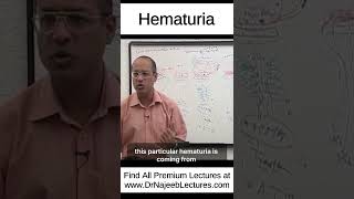 Hematuria shortvideo shorts drnajeeb drnajeeblectures [upl. by Ylrehc136]