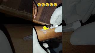 154 IV Cannula Technique  Cannula Insertation Procedure  Cannula Kaise Lagate Hai  short viral [upl. by Annawyt]