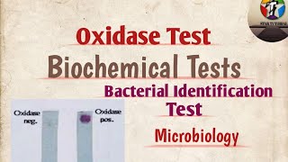 Oxidase Test ll Biochemical Tests ll Bacterial Identification ll Microbiology [upl. by Asatan]