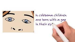 Microphthalmia Anophthalmia and Coloboma [upl. by Eseerahs824]