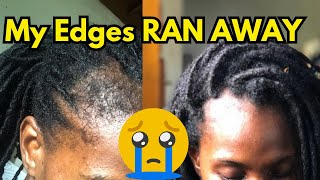 How To Regrow Your Edges Bald Spots And Thinning Hair [upl. by Nnaycart]