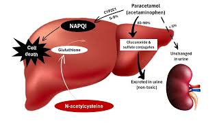 NAcetylcysteine amp Paracetamol Poisoning Rescue [upl. by Daisy]